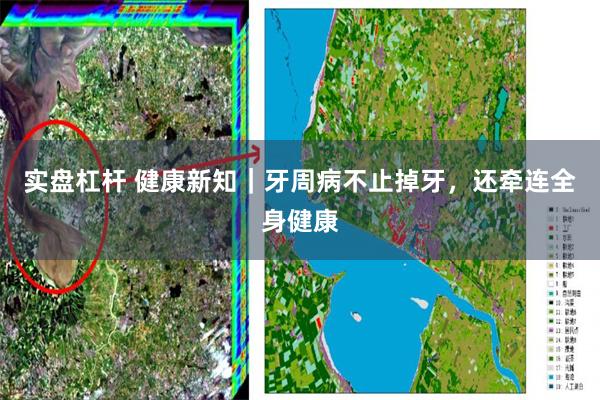 实盘杠杆 健康新知｜牙周病不止掉牙，还牵连全身健康